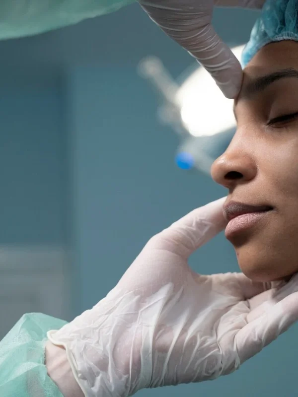 Rhinoplasty